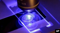 Las investigaciones microbiológicas han permitido a los científicos determinar los rangos de proliferación de los hongos y las enfermedades que causan, la resistencia a medicamentos causa preocupación por lo que la OMS ha focalizado atención en grupos. (Foto ilustrativa AP)
