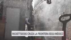 Aumentan muertes por rickettsiosis en Baja California