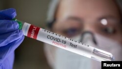 ARCHIVO -En esta ilustración se ve un tubo de ensayo con la etiqueta "COVID-19 Test positivo".
