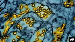 Partículas de la gripe aviar vistas bajo un microscopio. Foto suministrada por el Instituto Nacional de Alergias y Enfermedades Infecciosas el 26 de febrero del 2024. 